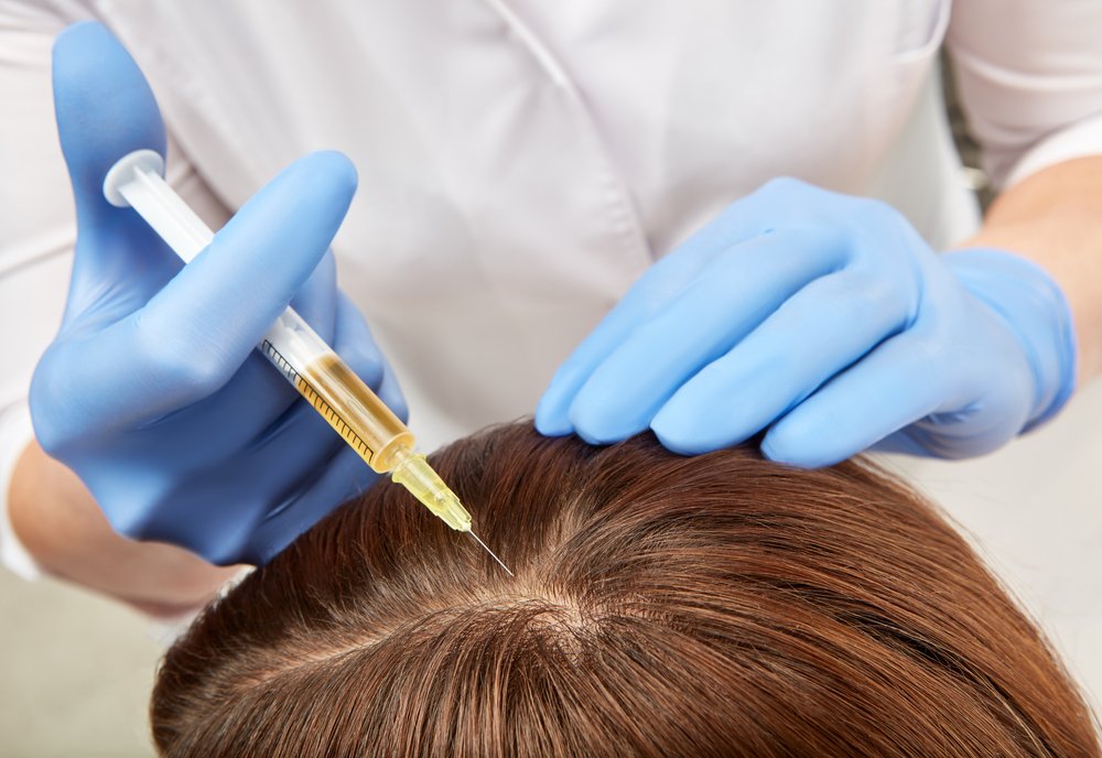 Hair Transplant PPC Illustration